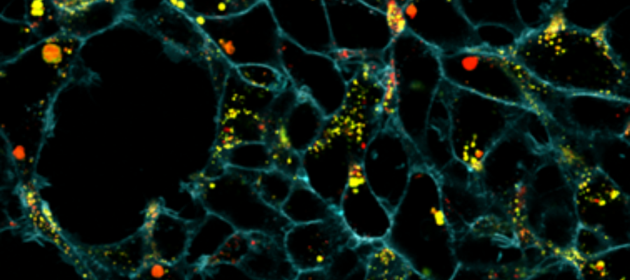 Fluorescent sensor that can track where and when a drug is released in ...