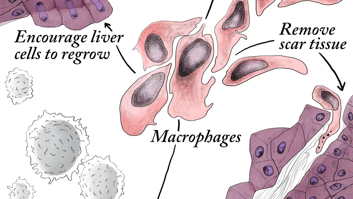 A scientific diagram showing how cell therapy using macrophages interacts with other cells in the liver