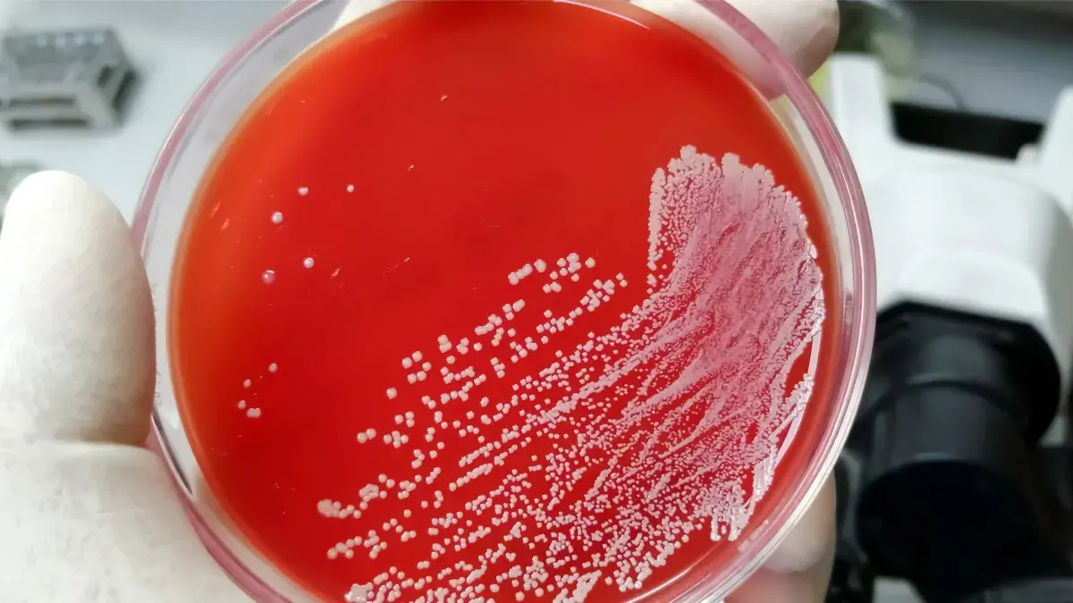 Agar dish with red medium, and white spots (bacteria) on the surface