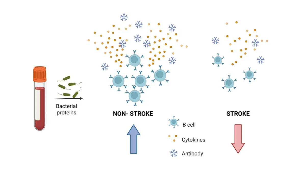 Comparison of immune cells after stroke vs no stroke