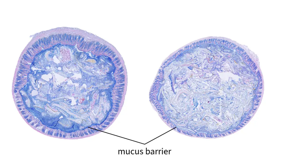 Two images showing the inside lumen of the intestine for comparison