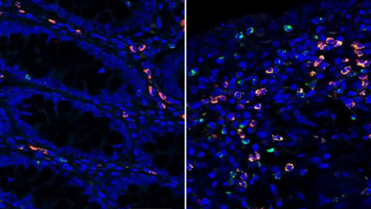 Microscopy images of blue cells and some highlighted different colours