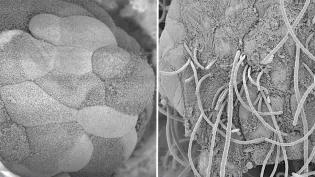 Microscope images of bacteria and bowel interactions. Left: Segmented Filamentous Bacteria (SFB) (long, stringy structures) are not seen in the irritated bowel; Right: SFB stick to the irritated bowel wall
