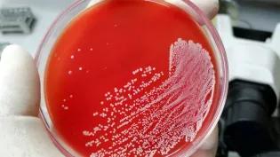 Agar dish with red medium, and white spots (bacteria) on the surface
