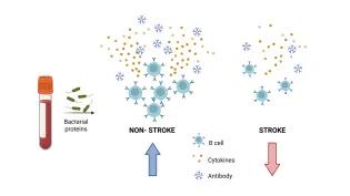 Comparison of immune cells after stroke vs no stroke