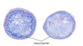 Two images showing the inside lumen of the intestine for comparison