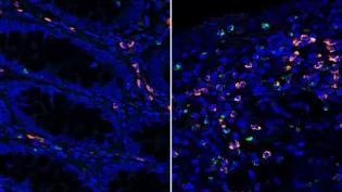 Microscopy images of blue cells and some highlighted different colours