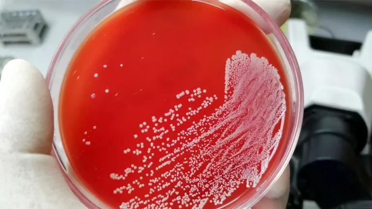 Agar dish with red medium, and white spots (bacteria) on the surface