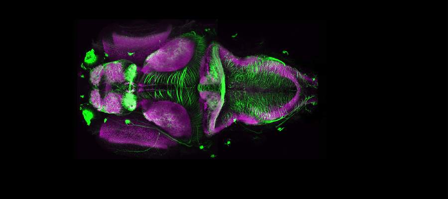 zebrafish brain