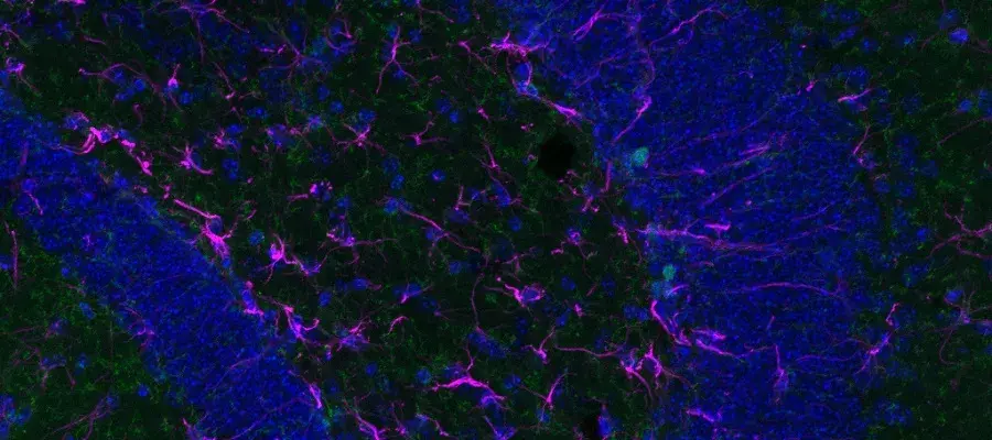 MVM confocal image of the hippocampus in Fmr1 mice