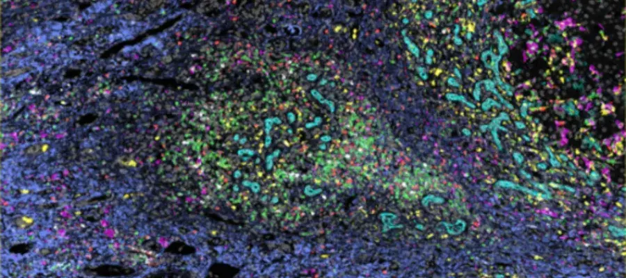 Microscopy image showing colourful stains of various markers