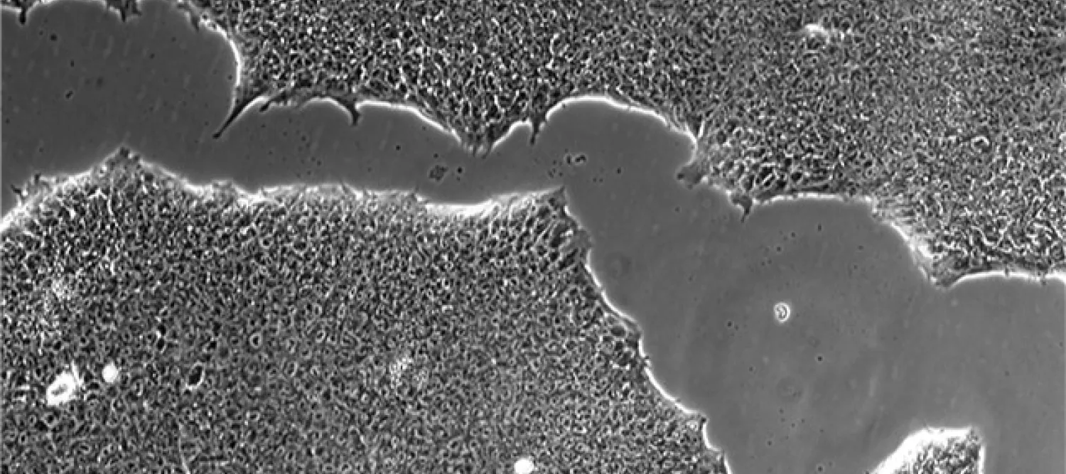 phase contrast of self-renewing IPSCs