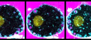 Macrophage precursor cells over time undergoing cell drinking, observable by the internalisation of pink fluid from outside the cell into small pink circular ‘bubbles’ and highlighted in the magnified image.
