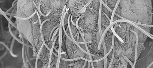 Microscopy image showing fine, thread-like structures (bacteria) interacting with bowel wall