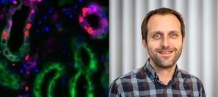 An image of two halves. On the left is a microscopy image of kidney tissue cells, marked with fluorescent colours; on the right, a headshot of David Baird