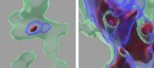 Brain immune cells called microglia (green), with internalised/cleared dead cell neuron-derived material (red). There is reduced dead cell clearance with high fructose that is then rescued by removal of the fructose transporters.