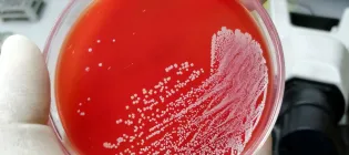 Agar dish with red medium, and white spots (bacteria) on the surface