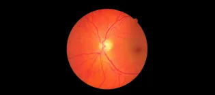 Retinal scan