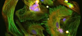 Fluorescence microscopy image