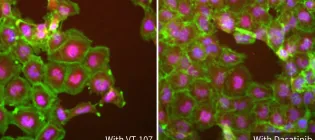 Two fluorescent microscopy images of cancer cells with drug VT-107 (left) causing less YAP activity inside the cell nucleus (magenta), with minimal impact on cell shape (green), compared to dasatinib drug (right).