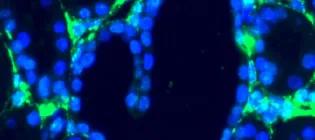 Fluorescent microscopy image with blue cells in the shape of a heart