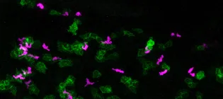 Image from the paper showing fluorescent cells. Magenta-coloured magenta cells have migrated down into green-coloured skin cell tissue