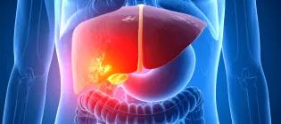 AI generated image of liver disease