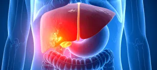 AI generated image of liver disease