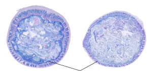 Two images showing the inside lumen of the intestine for comparison