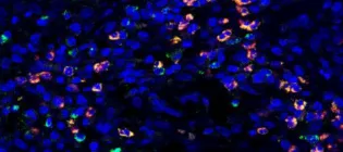 Microscopy image showing blue cells, some of which are highlighted a different colour