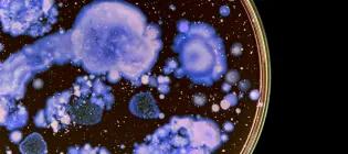 Close up of a petri dish with purple bacteria growing in colonies on the gel