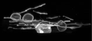 Oligodendrocytes in zebrafish exhibiting myelin swelling. They look like whice see-through spheres and sticks on top of a black background