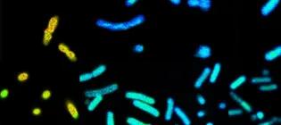 Different bacteria fluorescing yello, teal and indigo