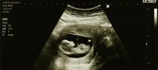 Debby Bogaert early life paper
