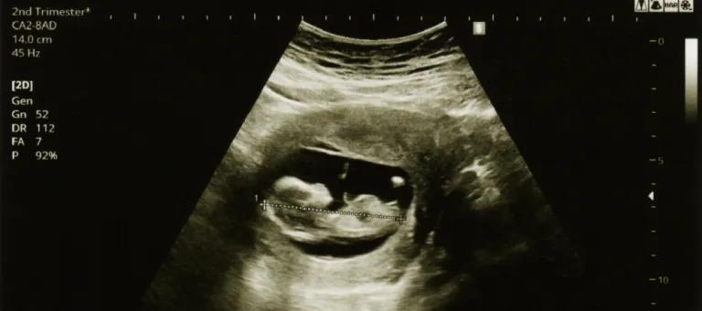 Debby Bogaert early life paper