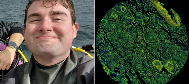 Alex Hunt headshot on the left with a microscopy image on right which has varying degrees of green shades.