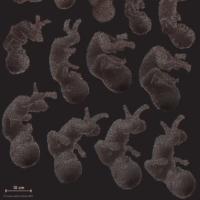 graphic of fetus development using data