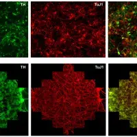 TH:TuJ1 immunostaining image