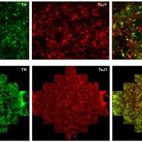 TH:TuJ1 immunostaining image