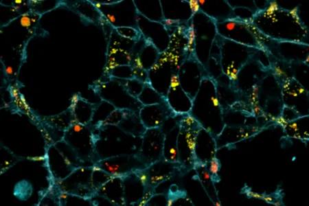 Microscopic image showing cells (coloured cyan), with yellow and red fluorescent dots signifying the drug and lysosomes (part of a cell) 