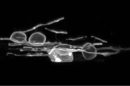 Oligodendrocytes in zebrafish exhibiting myelin swelling. They look like whice see-through spheres and sticks on top of a black background