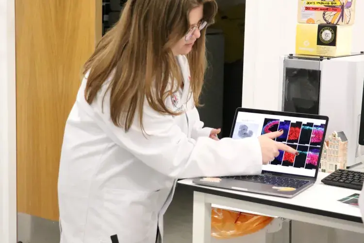Researcher points to  laptop screen with images of fluorescent red and purple labelled brain slices