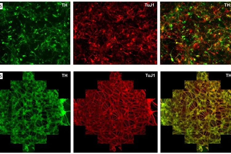 TH:TuJ1 immunostaining image