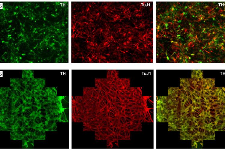 TH:TuJ1 immunostaining image