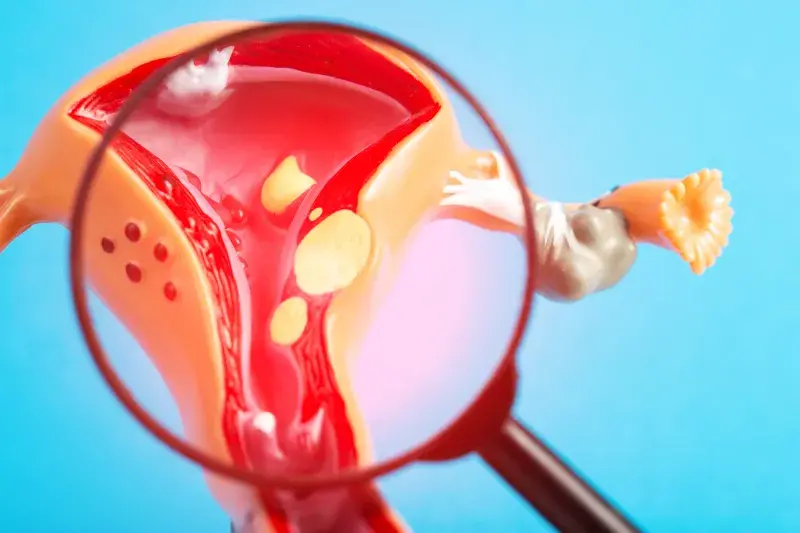 A graphical illustration of a magnifying glass looking at a uterus with cancer growing in it