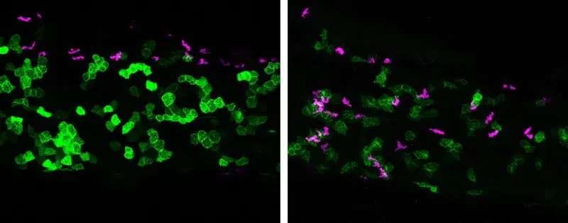 Fluorescent microscopy slides. Image on left as bright magenta cells collecting at the top of the skin's surface). Image on right shows these magenta cells have migrated down amongst the green skin cells.