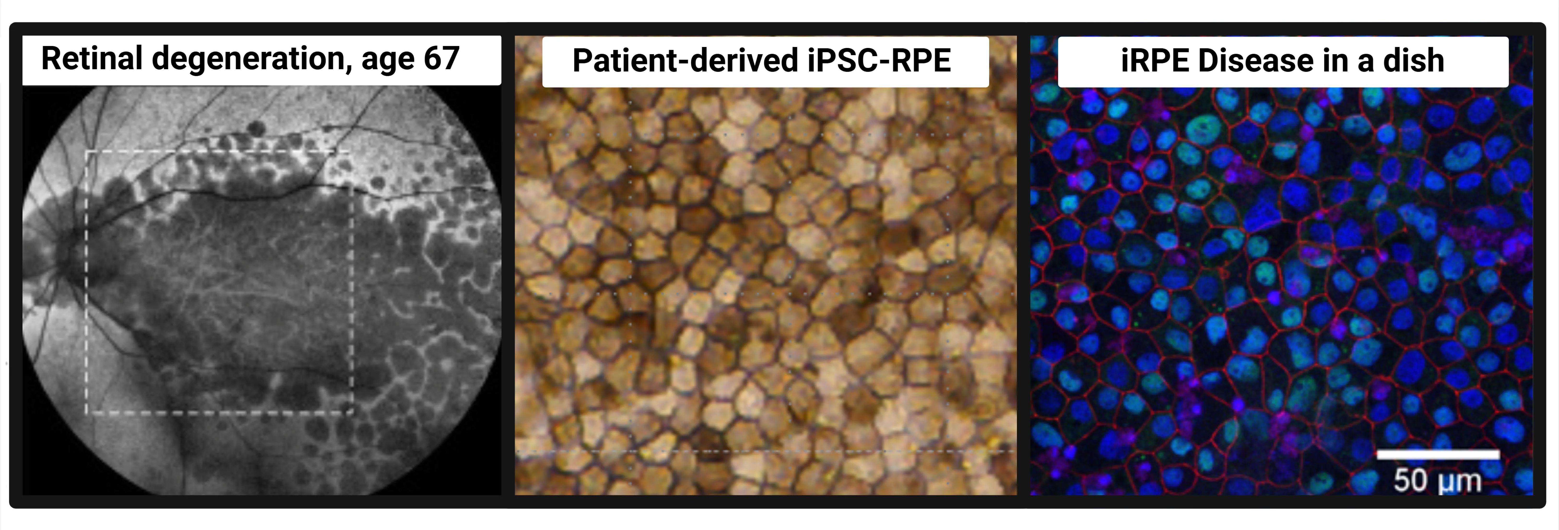 Three separate images showing retinal cells in different formats