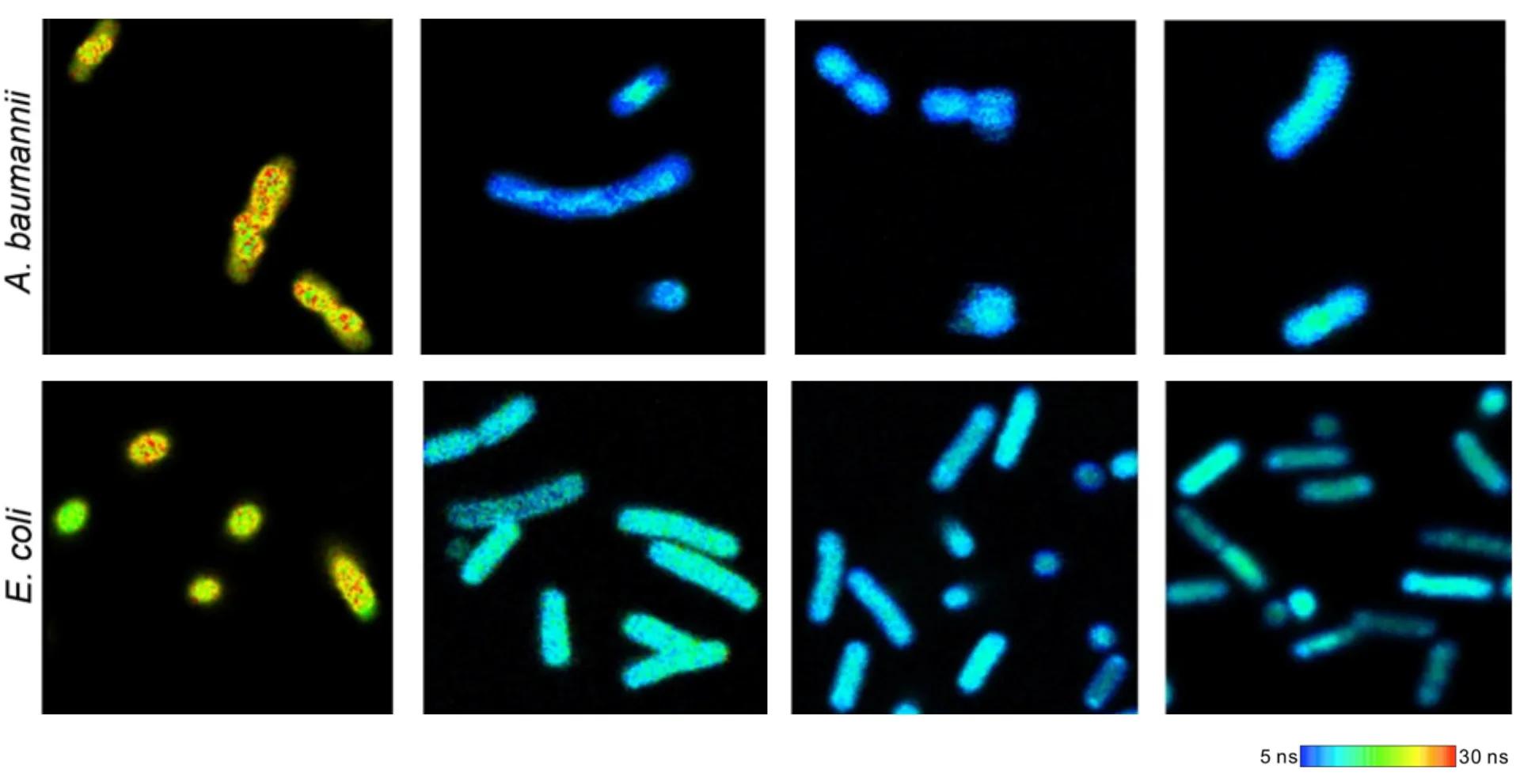 2 rows of 4, showing different teal and yellow fluorescence depending on the bacterial species