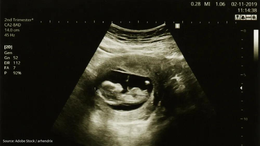 Debby Bogaert early life paper