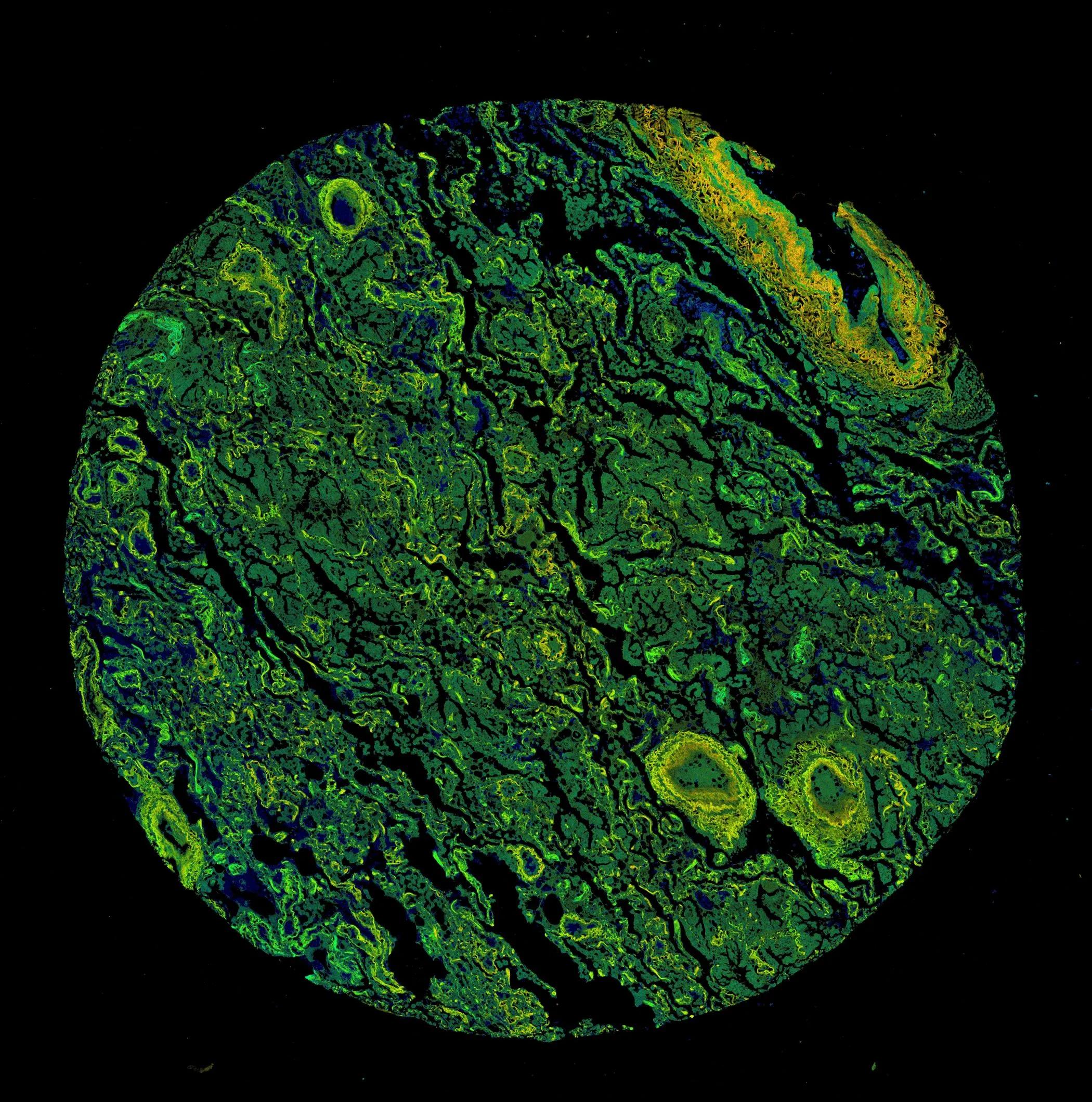 Microscopy image of cells highlighted in shades of green